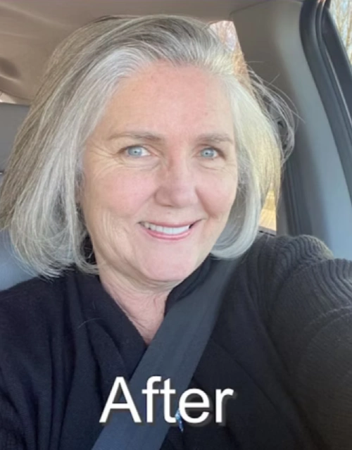 susan-after